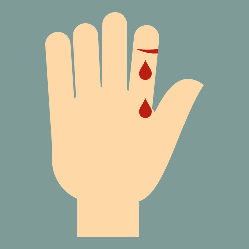 a hand with a cut